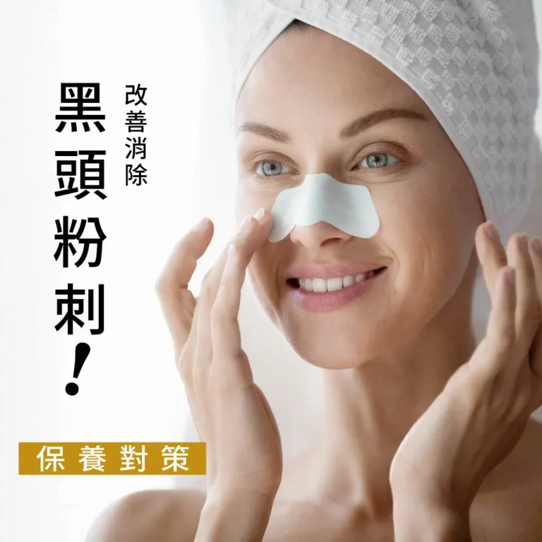 改善「粉刺、面皰」保養對策